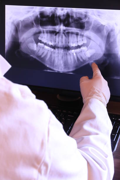 Best Emergency Dentist for Lost Fillings or Crowns in Keenesburg, CO